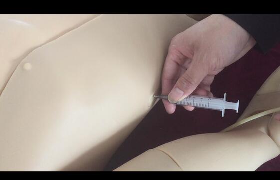 1494219929930641.jpg 穿刺注射2