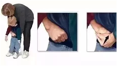 寶寶誤吞異物,怎么緊急處理! 寶寶誤吞異物,怎么緊急處理!